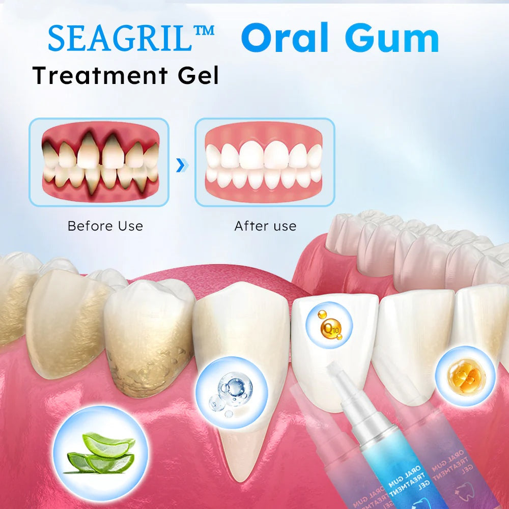 SEAGRIL™ Oral Gum Treatment Gel(🔥Limited Time Discount)