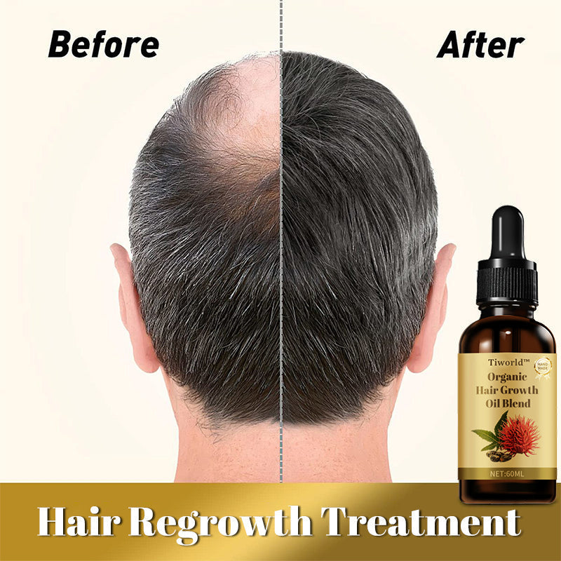 Tiworld™ Organic hair growth oil blend