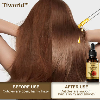 Tiworld™ Organic hair growth oil blend